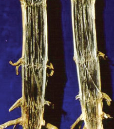 Stalk Rot